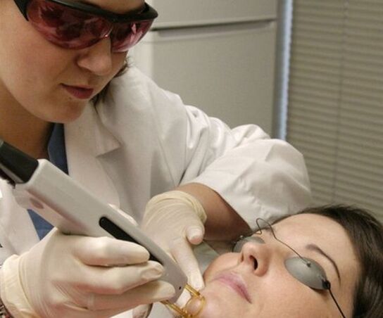 Laser procedure for facial skin rejuvenation