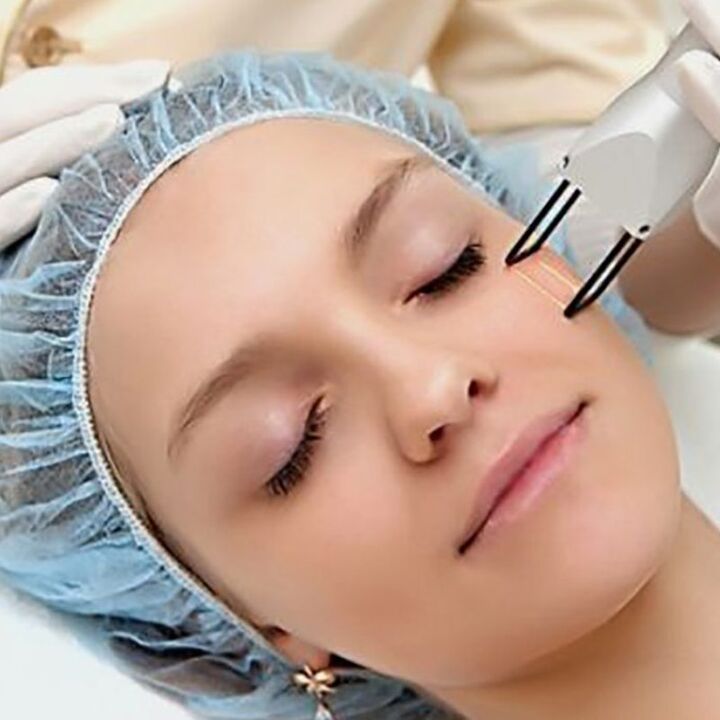 Laser fractional rejuvenation
